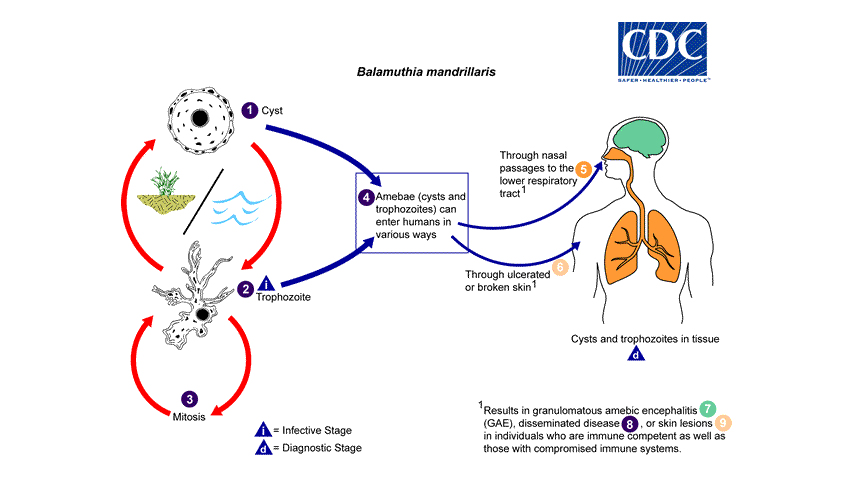 diagram how brain-eating bacteria kills people