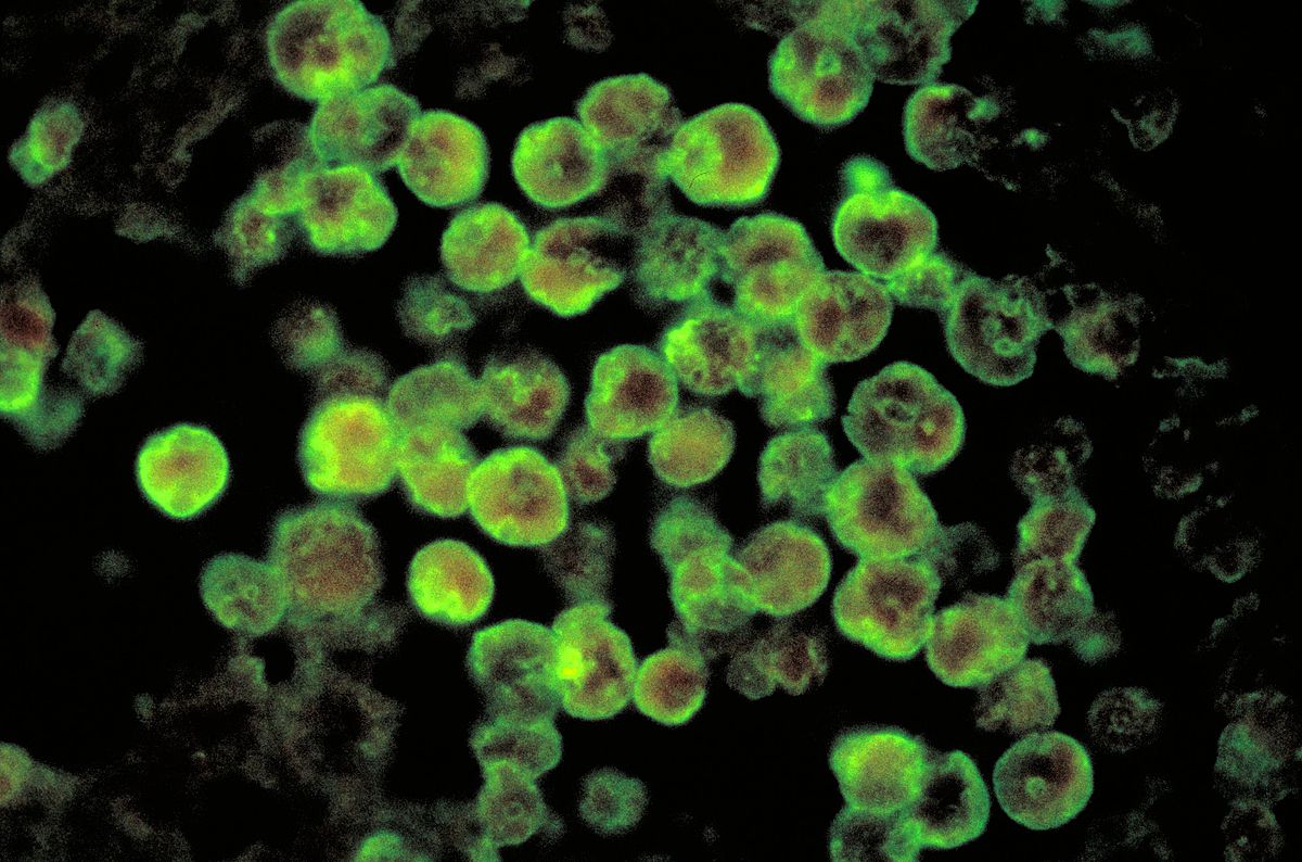 brain-eating amoeba image courtesy of the CDC